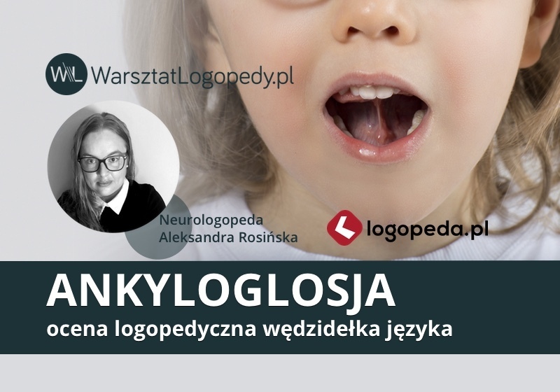 Ankyloglosja - logopedyczna ocena wędzidełka języka